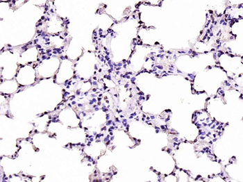 JAK2 antibody