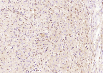 Jnk1/3 antibody