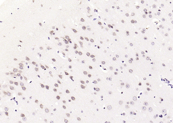 JNK1/2/3 (phospho-Thr183/185) antibody