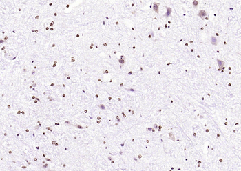 JNK1/2/3 (phospho-Thr183/185) antibody