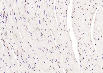 JNK1/2/3 (phospho-Thr183/185) antibody