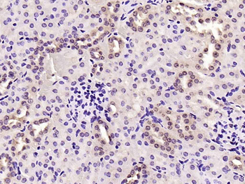 JNK1/2/3 (phospho-Thr183/185) antibody