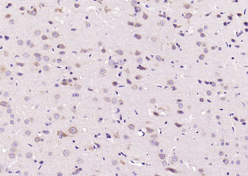 JNK1/2/3 (phospho-Thr183/185) antibody