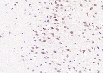 JNK1/2/3 (phospho-Thr183/185) antibody