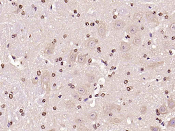 JNK1/2/3 (phospho-Thr183/185) antibody