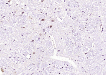 JNK1/2/3 (phospho-Thr183/185) antibody