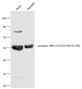 JNK1/2/3 (phospho-Thr183/185) antibody