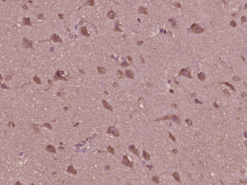 JNK1/2/3 (phospho-Thr183/185) antibody