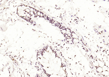 JNK1/2/3 (phospho-Thr183/185) antibody