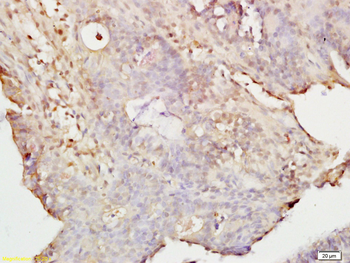 pan Ras antibody