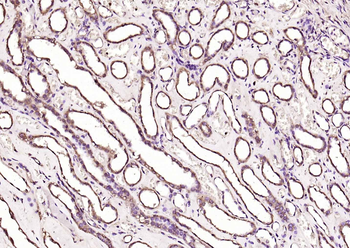 pan Ras antibody