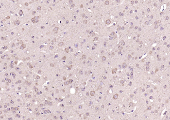 pan Ras antibody