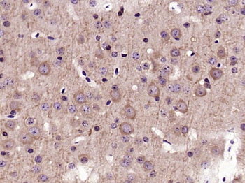 pan Ras antibody