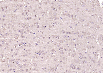 pan Ras antibody