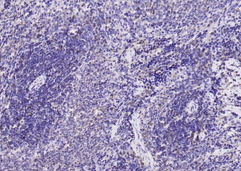 pan Ras antibody