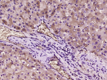 OxLDL antibody