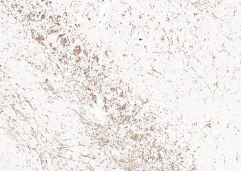 MBP antibody