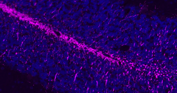 MBP antibody