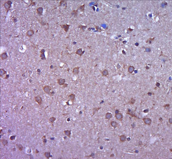 MMP2 antibody