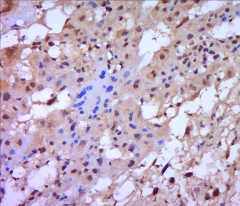 MMP2 antibody