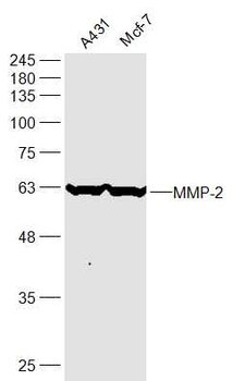 MMP2 antibody