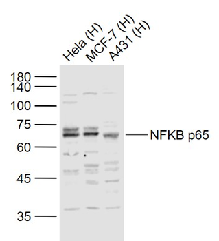 NFkB p65 antibody