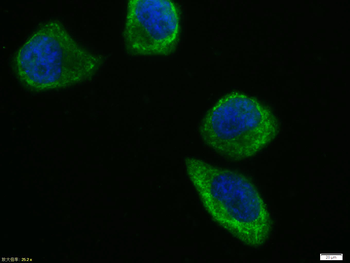 NFkB p65 antibody