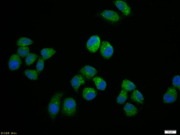 NFkB p65 antibody