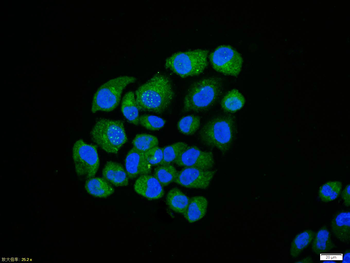 NFkB p65 antibody