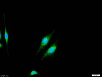 NFkB p65 antibody