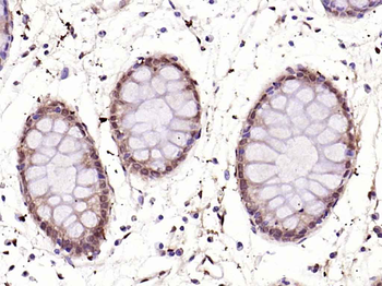 NFkB p65 antibody