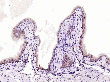 NFkB p65 antibody