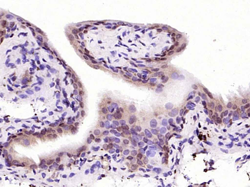 NFkB p65 antibody