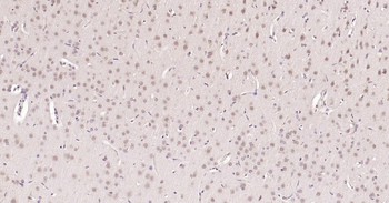 Nurr1 antibody