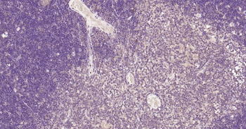 Nurr1 antibody