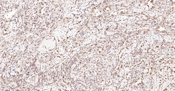 Nurr1 antibody