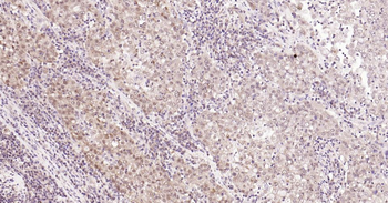 Nurr1 antibody