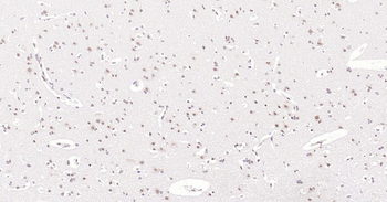 Nurr1 antibody