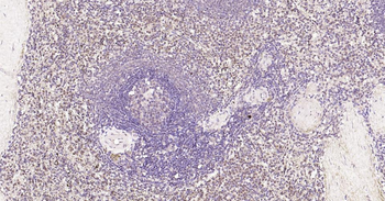 Nurr1 antibody