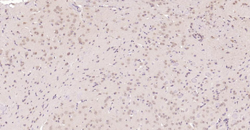 Nurr1 antibody