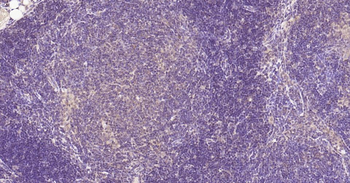 Nurr1 antibody