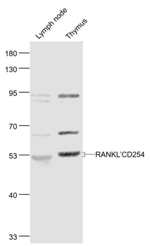 RANKL antibody