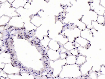 p21 antibody