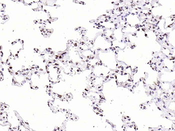 p21 antibody