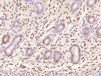 p21 antibody