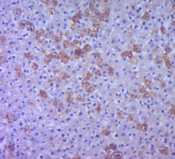 MAPK14 antibody