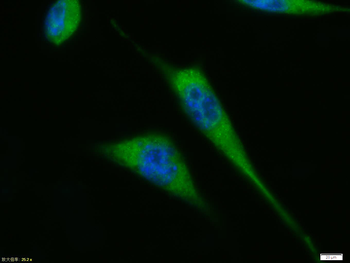 p53 antibody