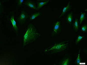 p53 antibody