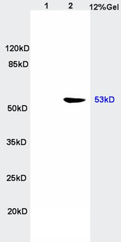 p53 antibody