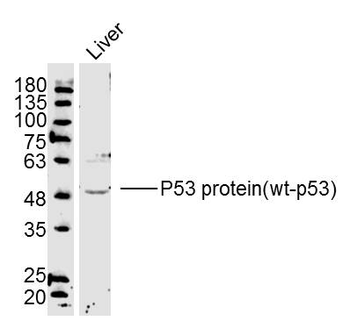 p53 antibody